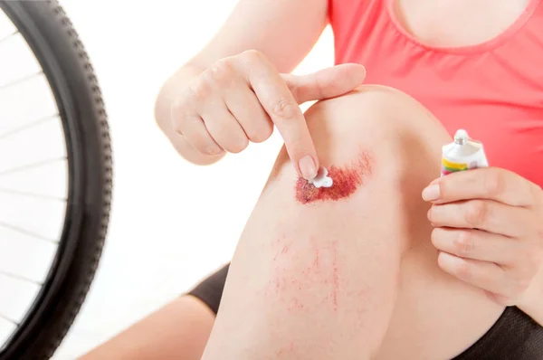 Mujer ungüento ungüento rota rodilla sentado cerca de la rueda de la bicicleta — Foto de Stock