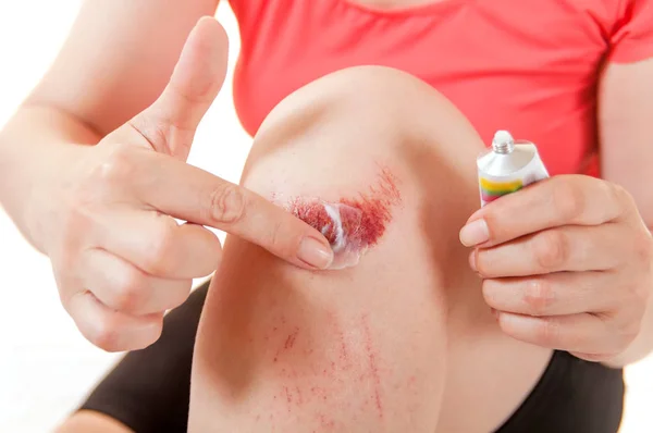 kadın smear merhem kırık diz üstünde, yakın çekim