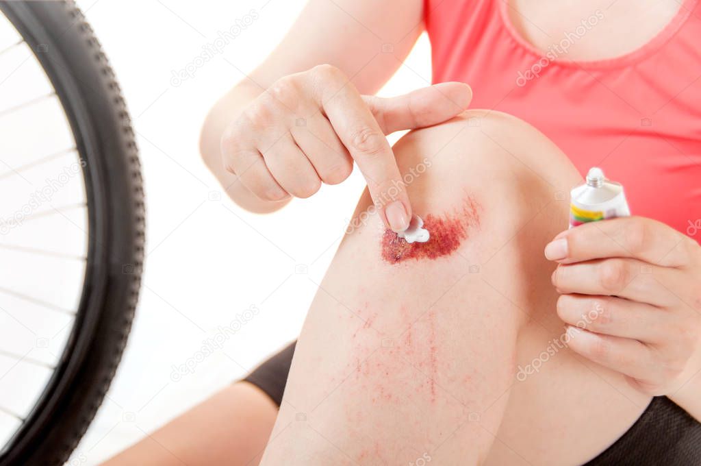 woman smears ointment broken knee sitting near the bicycle wheel