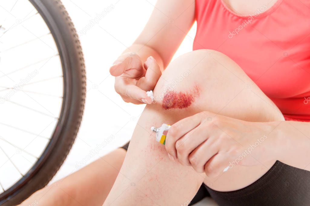 woman smears ointment knee, broken on a bicycle walk, closeup