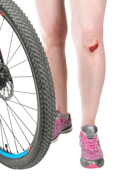 Frau Mit Gebrochenem Knie Auf Dem Fahrrad Nahaufnahme — Stockfoto