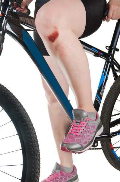 Frau Mit Gebrochenem Knie Auf Dem Fahrrad Nahaufnahme — Stockfoto