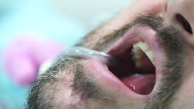 Dişçi bir hastayı tedavi eder. Yüksek kaliteli FullHD görüntüler
