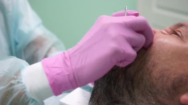 O dentista trata um paciente. Imagens FullHD de alta qualidade — Vídeo de Stock