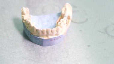 Kapalı ellerde diş hekimi takma diş temizliği doktoru yapar.