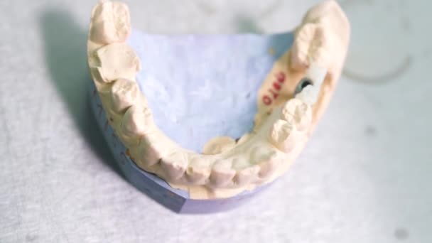 Primo piano mani dentista fa una dentiera pulizia dei denti medico — Video Stock