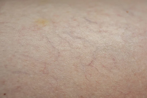 doğmakta olan varisler, cilt arka planı