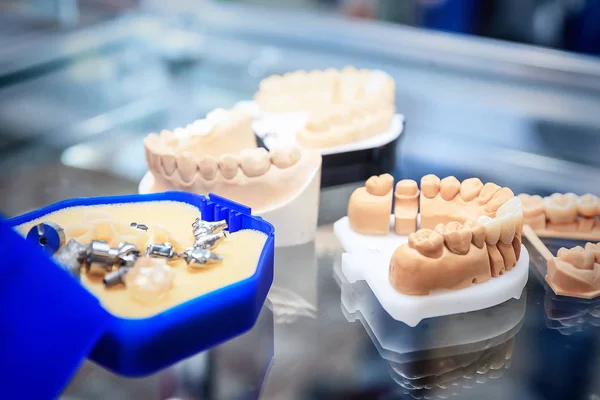 Coulées de prothèses dentaires . — Photo