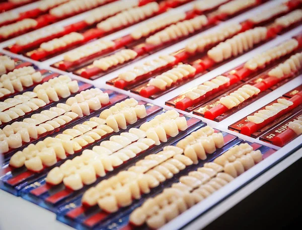 Vari campioni di impianti dentali — Foto Stock