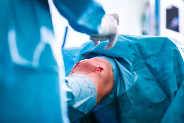 膝关节外科 骨科手术 两个外科医生 一次膝盖手术病人 浅景深 定了调子的彩色图像 — 图库照片