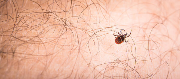 Tick - parasitic arachnid blood-sucking 