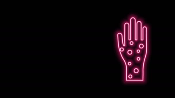 Gloeiende neon lijn Hand met psoriasis of eczeem pictogram geïsoleerd op zwarte achtergrond. Concept van de menselijke huidrespons op allergeen of chronisch lichaamsprobleem. 4K Video motion grafische animatie — Stockvideo