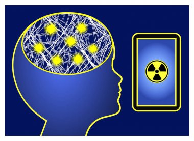 Cep telefonu radyasyonu epilepsi tetikler. Çocuklar ve epileptik nöbetlerde elektronik dalgaların etkisi 