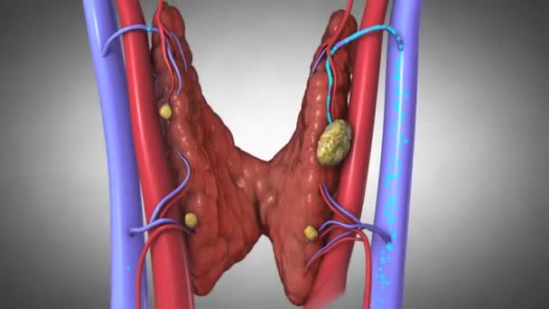 903 Thyroid Videos, Royalty-free Stock Thyroid Footage | Depositphotos 903 Thyroid Videos, Royalty-free Stock Thyroid Footage | Depositphotos