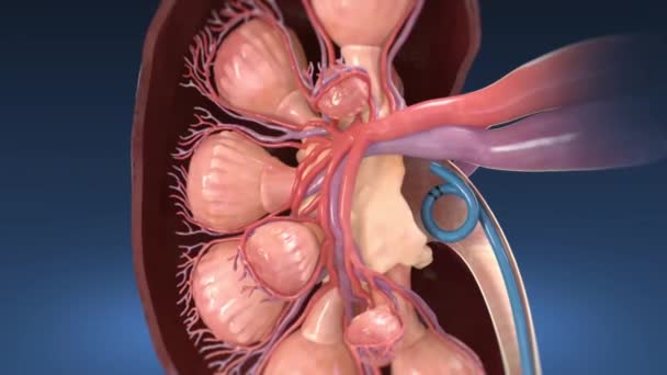 Kidney and endoscopy — Stock Footage Kidney and endoscopy Stock Footage