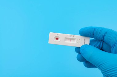 Koronavirüs salgını ve Covid-19 konsepti kontrol hattı ile immünoglobülin antikor kan testi yapan doktor IgG ve IgM çizgileri mavi arka planda kopya alanı olan pozitif izolasyon gösteriyor.
