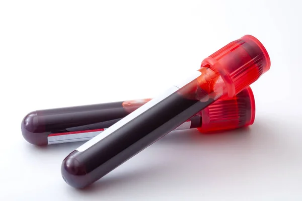 Phlebotomy, biyokimyasal analiz, laboratuvar muayenesi ve kan testi konsepti teması beyaz arka planda izole edilmiş iki test tüpü ile