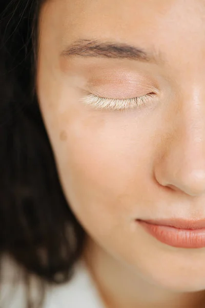 Metà Della Bella Faccia Bruna Con Belle Ciglia Vitiligine Bianche — Foto Stock