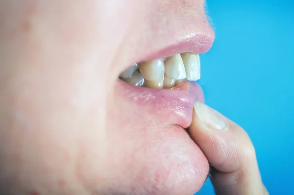 歯科医院の女性の歯のクローズ アップ — ストック写真