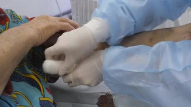 Hemodiyaliz. Makine yapay böbrek