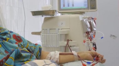 Hemodiyaliz. Makine yapay böbrek