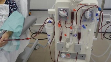Hemodiyaliz. Makine yapay böbrek