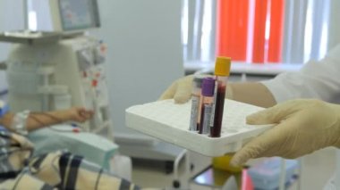 Hemodiyaliz merkezi. Bir kişi bağlanma.