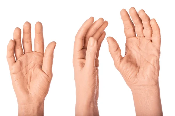 Groep silicone prothese handen, geneeskunde roze implantaten — Stockfoto
