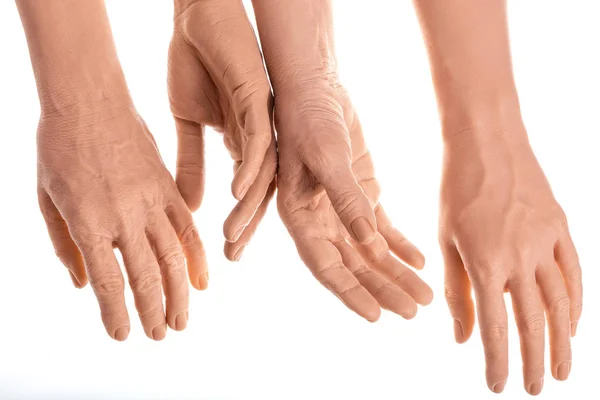 Grupa silikonowe protezy ręce, medycyna różowy implanty — Zdjęcie stockowe