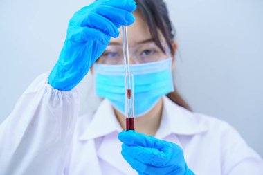 Laboratuvarda, COVID, COVID-19, Coronavirus virüsü analizi için test tüpündeki kan örneğini analiz eden bir teknisyen.