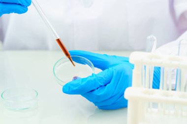 Laboratuvardaki kan örneğini COVID, COVID-19, Coronavirus virüsü analizi için analiz eden teknisyen bilim adamı.