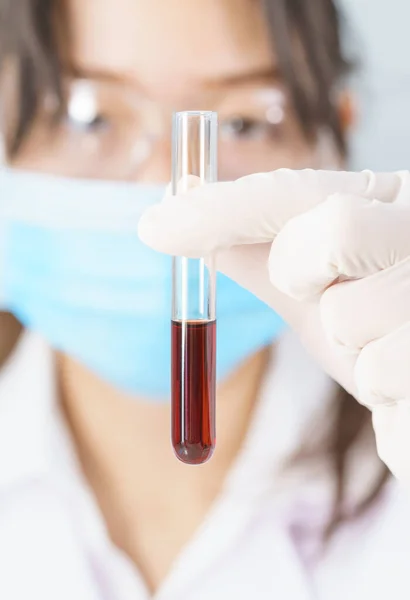Technician Scientist Analyzing Holding Blood Sample Test Tube Laboratory Testing — Stock Photo, Image