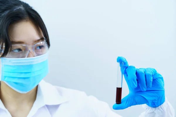Technician Scientist Analyzing Holding Blood Sample Test Tube Laboratory Testing — Stock Photo, Image
