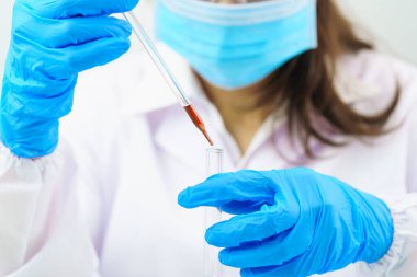 Laboratuvarda, COVID, COVID-19, Coronavirus virüsü analizi için test tüpündeki kan örneğini analiz eden bir teknisyen.