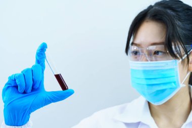 Laboratuvarda kan örneğini COVID, COVID-19, Coronavirus virüsü analizi için test tüpünde tutan teknisyen uzmanı.