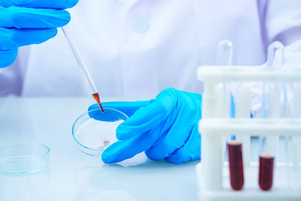 Científico Técnico Analizando Una Muestra Sangre Bandeja Laboratorio Para Analizarla — Foto de Stock