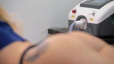 Doktor bir dövme lazer kaldırma aygıt ile video kalça kaldırma