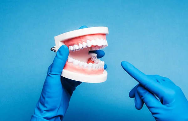 Mãos em luvas azuis segurando modelo de dentes dentários — Fotografia de Stock