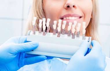 Diş renk paletini tutan diş hekimi