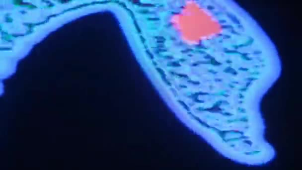 Résumé Texture Fond Bruit Glitch Tv Erreur 