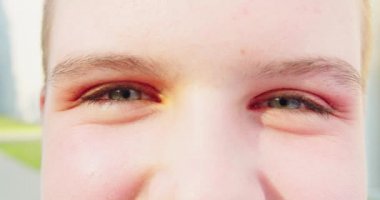 Young Ladys Eyes Blinking Outdoors