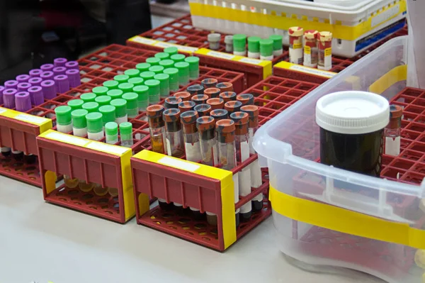 Sangue Espera Ser Processado Testado Laboratório Sangue — Fotografia de Stock