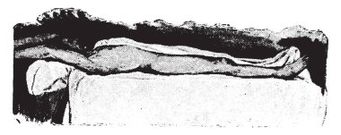 Islak sayfalık paket, hasta kısmen kaplı, vintage oyma.