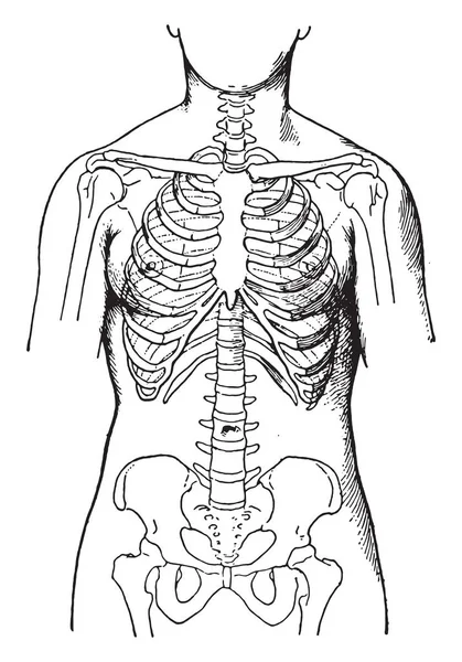 Παραμορφωμένο Από Την Κορσέδες Δείχνει Την Κατάσταση Των Οστών Γυναίκες — Διανυσματικό Αρχείο