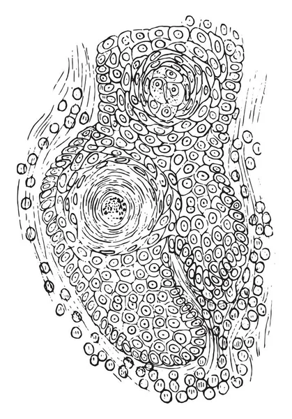 Секция Плоской Эпителиомы Винтажная Гравированная Иллюстрация — стоковый вектор