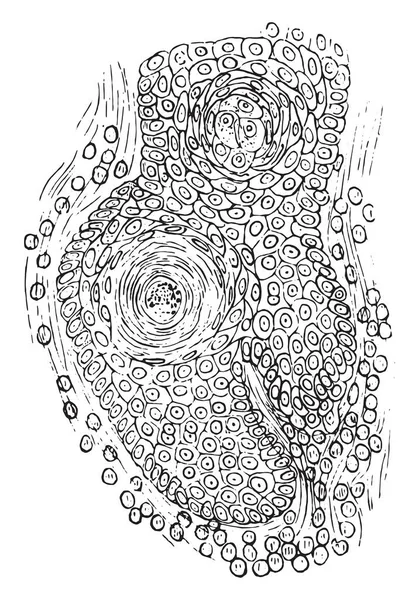 Sekcja Epithelioma Nabłonka Wielowarstwowego Płaskiego Vintage Ilustracji Grawerowane — Wektor stockowy