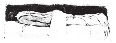 Kışkırtma omurga için uygulama yöntemi vintage oyma.