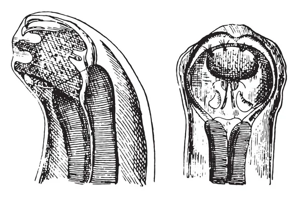 Cephalic Extremity Dochmius Duodenalis Vintage Engraved Illustration — Stock Vector