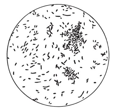 Sözde tepki, vintage oyma.