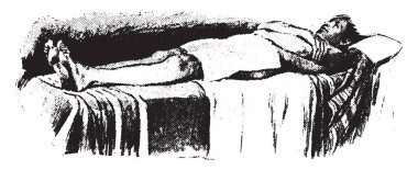 Sıcak kalça paketi, battaniye pozisyonda, vintage oyma.